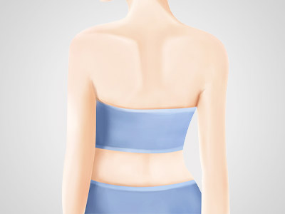 瘦颈瘦背局部减肥纤体方案